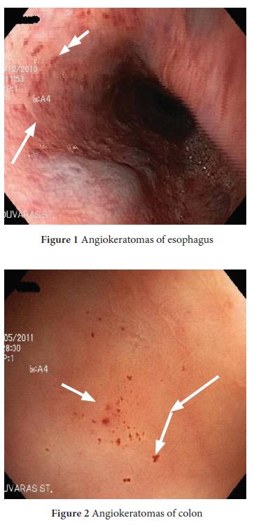 fabry disease endoscopic skin colon appearance angiokeratomas annalsgastro sigmoid